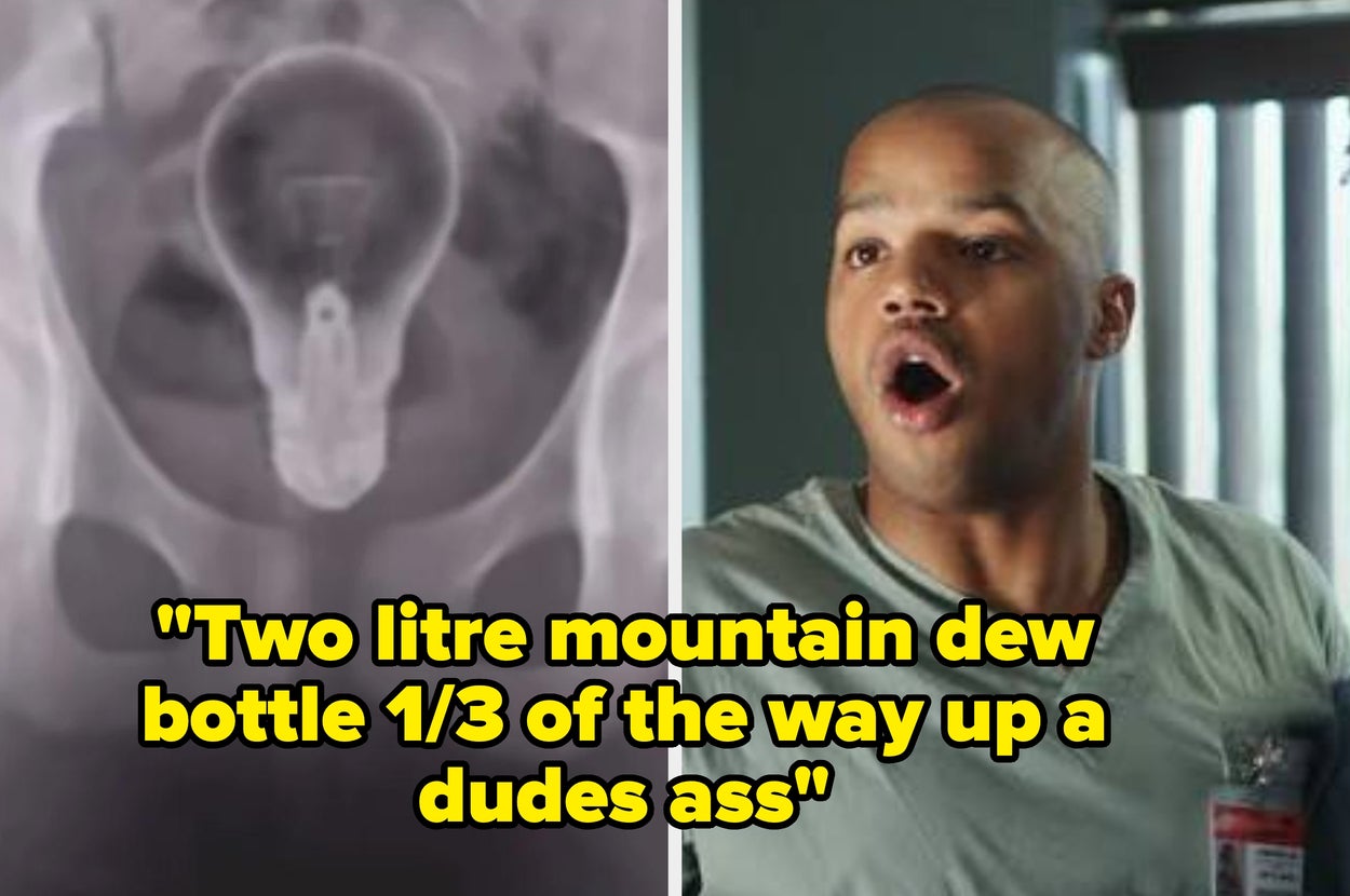 ER Workers Share Their Most Ridiculous Stories