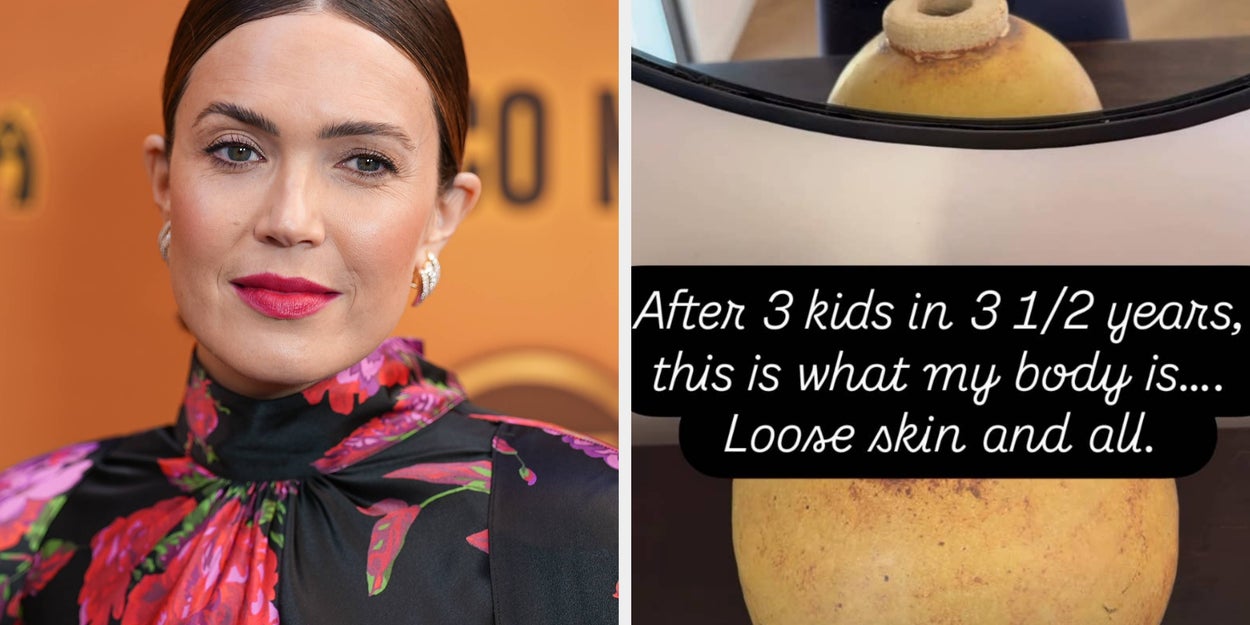 Mandy Moore Shares Honest Look At Body After 3 Kids