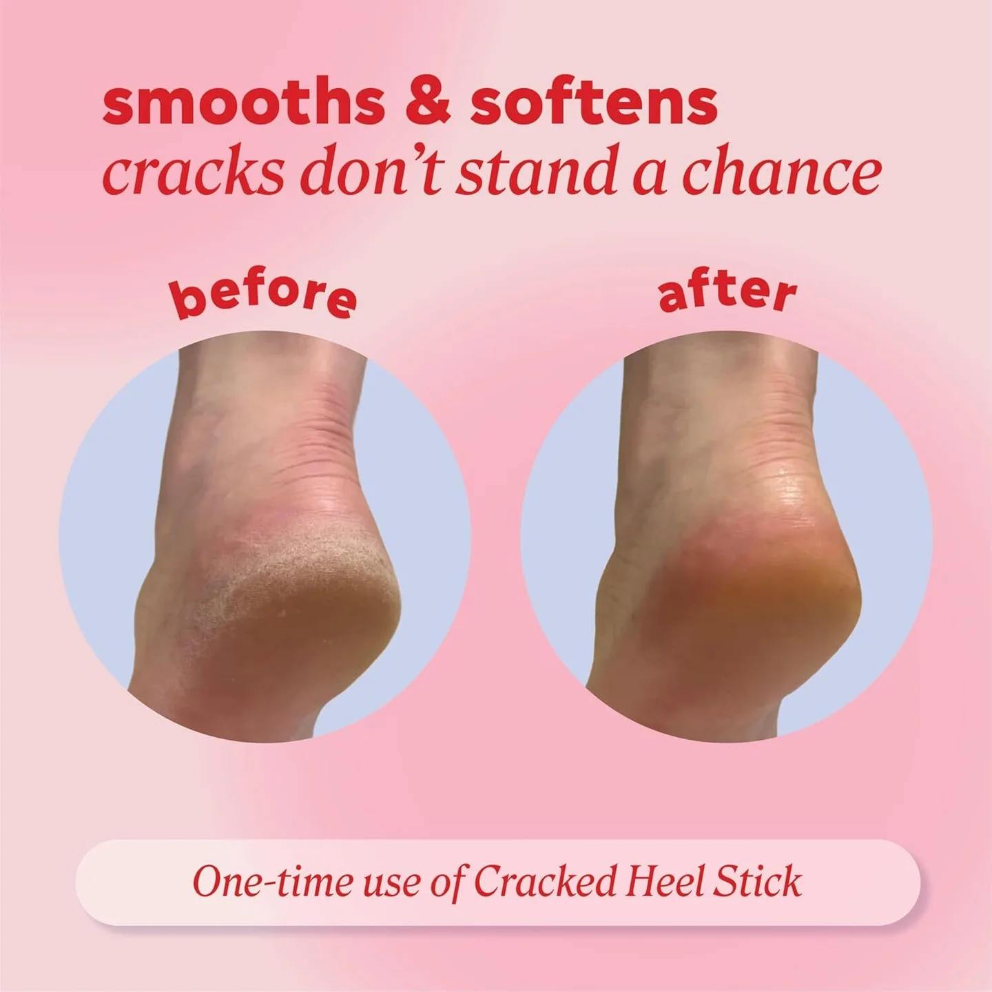 My Heels Were Painfully Cracked Until I Found This Mess-Free Balm