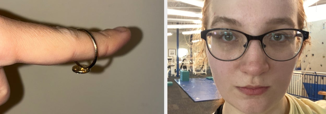 "I Got HAIRY": These Are The Weirdest Changes My Body Has Undergone Since Losing Weight And Gaining Muscle
