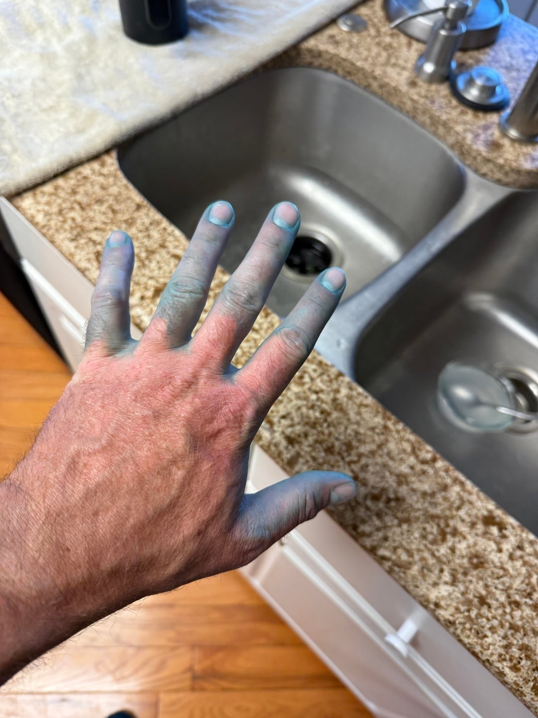 Person's hand stained blue beside a kitchen sink