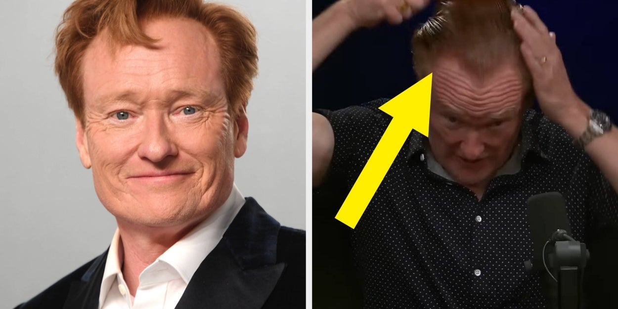 Conan O'Brien Explains New Hairstyle