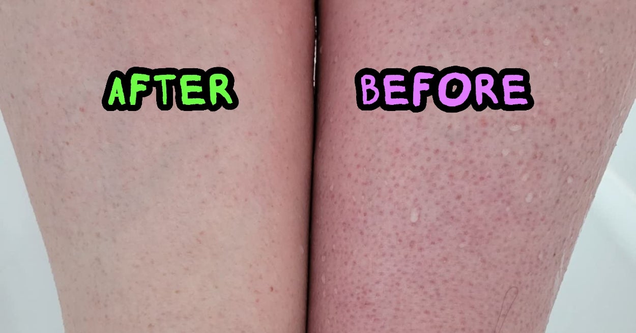 I'm Not Saying These 37 Products Are The Result Of Witchcraft But The Before And Afters Might Convince You Otherwise