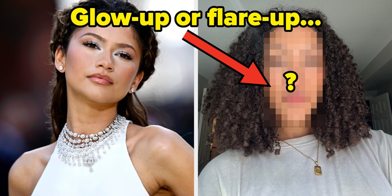 I Tried The Moisturizer Zendaya Used At "The Odyssey" Premiere On My Sensitive Skin, And Here's How It Went
