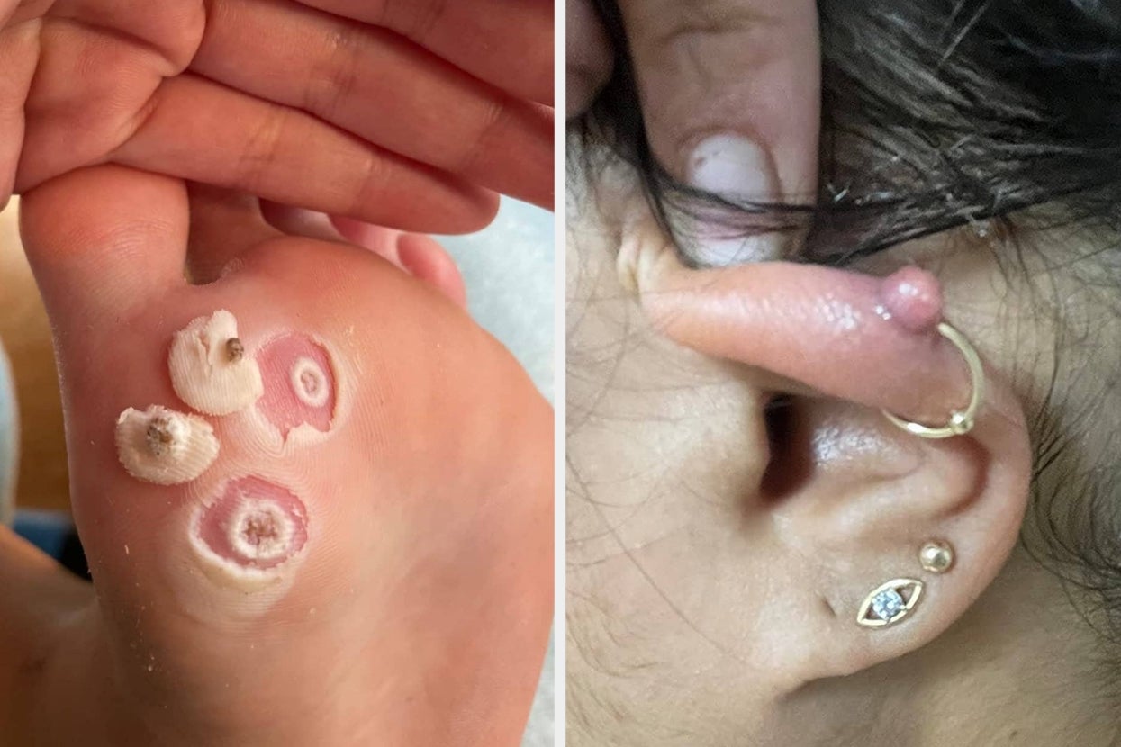 27 Body Care Products With Before And After Pics That’ll Give You A Visceral Reaction