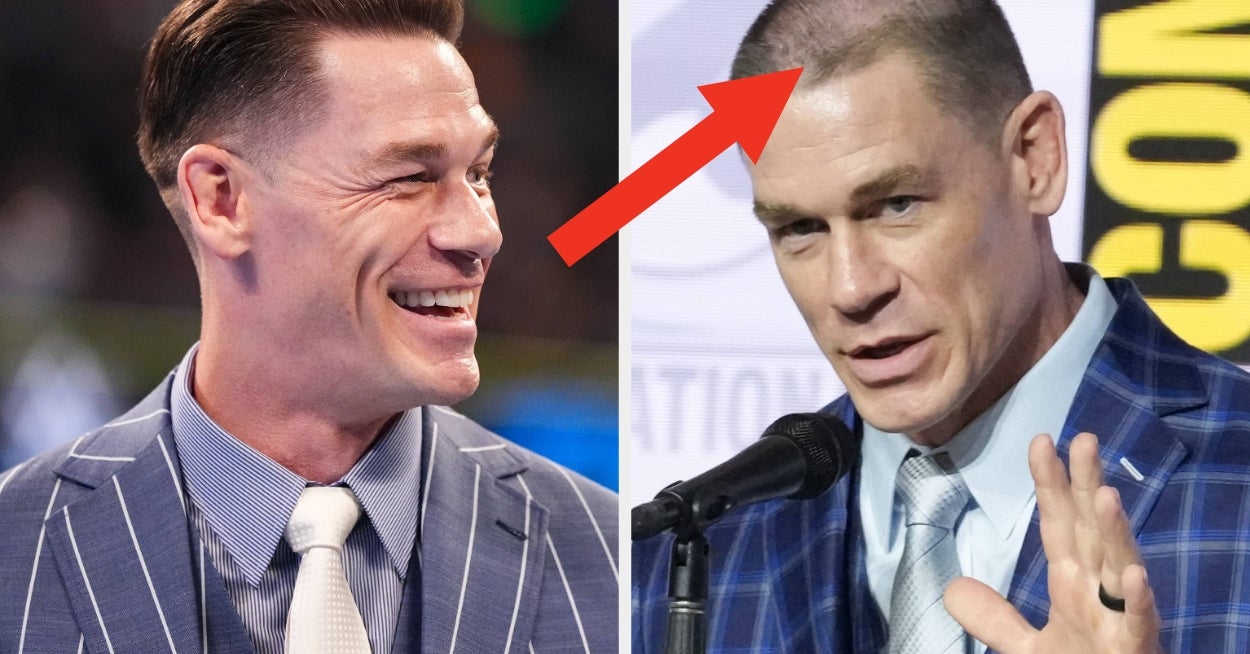 John Cena Opens Up His 2 Hair Transplants