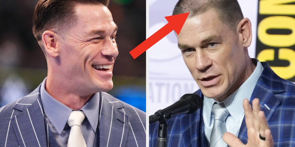 John Cena Opens Up His 2 Hair Transplants