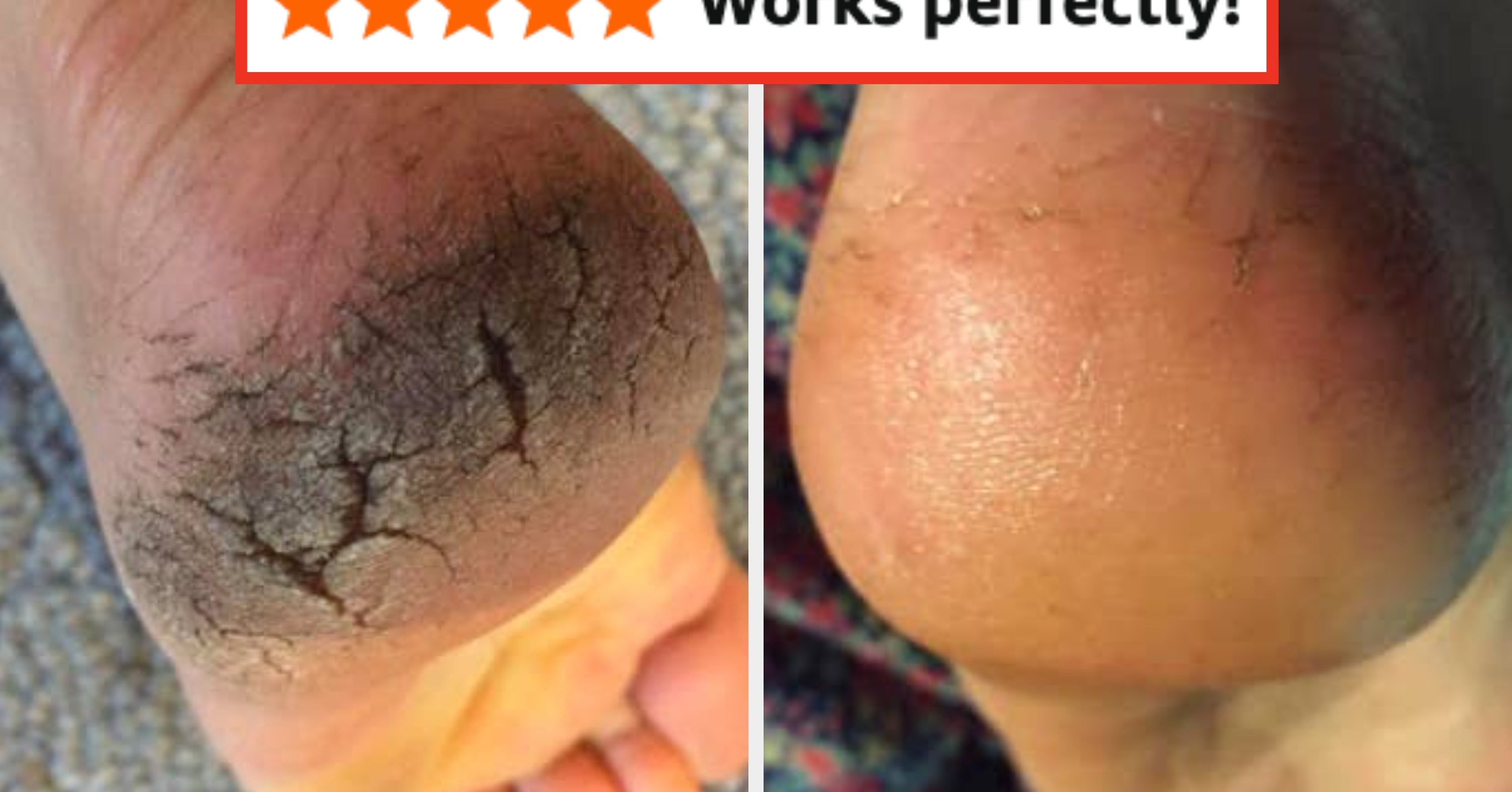 32 Beauty Products That Skip The Fancy Packaging And Concentrate On Results Instead