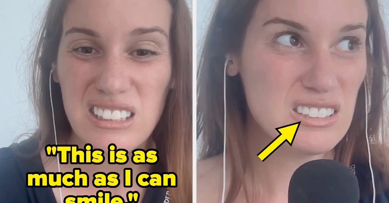 This Celebrity Podcaster Got Botox For Her TMJ, And It Went Horribly Wrong — Now She's Laughing About It With The Rest Of The Internet