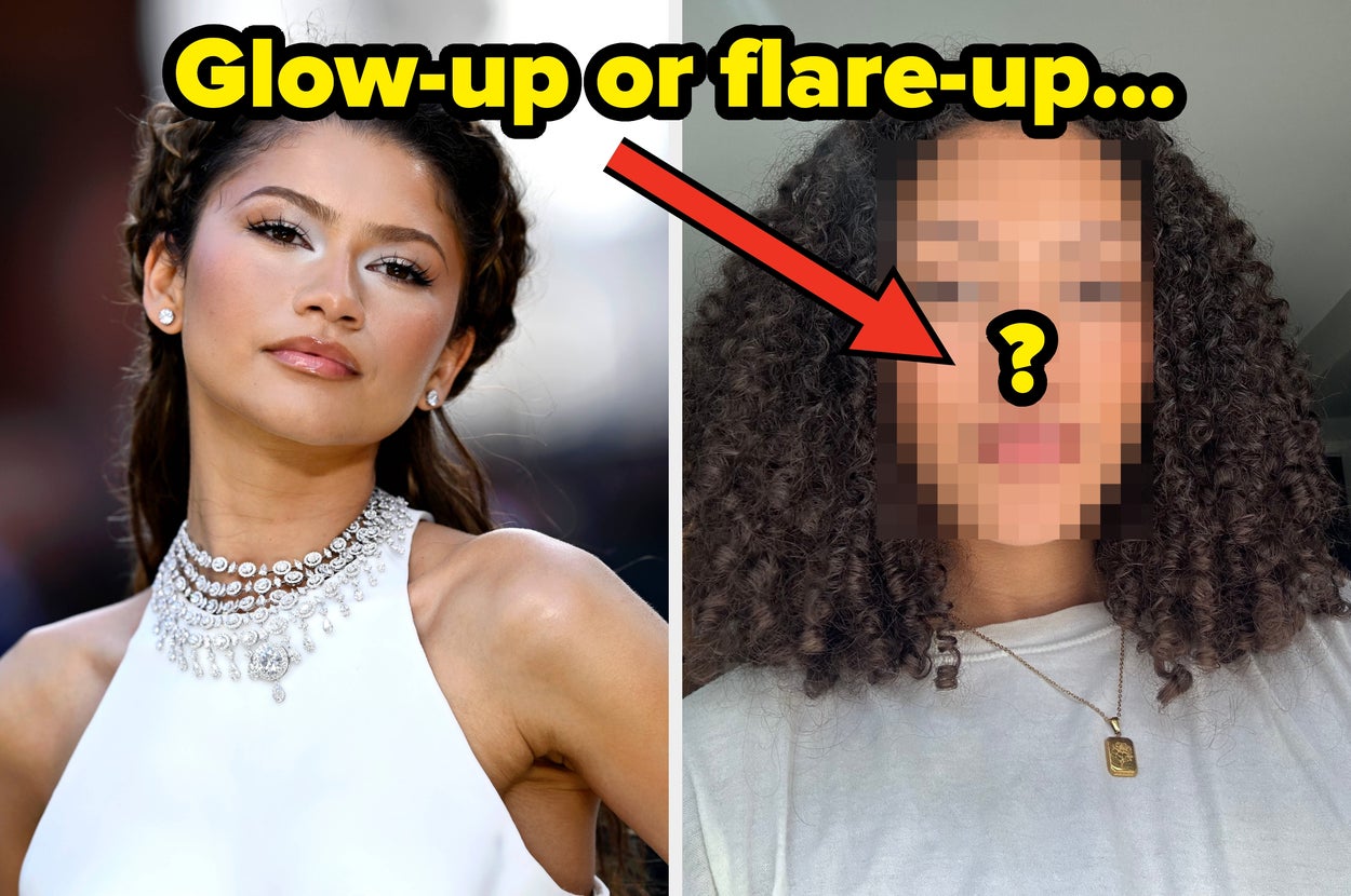 As Someone With Sensitive Skin, I Tried The Charlotte Tilbury Moisturizer That Zendaya Used At “The Odyssey” Premiere To See How It Works