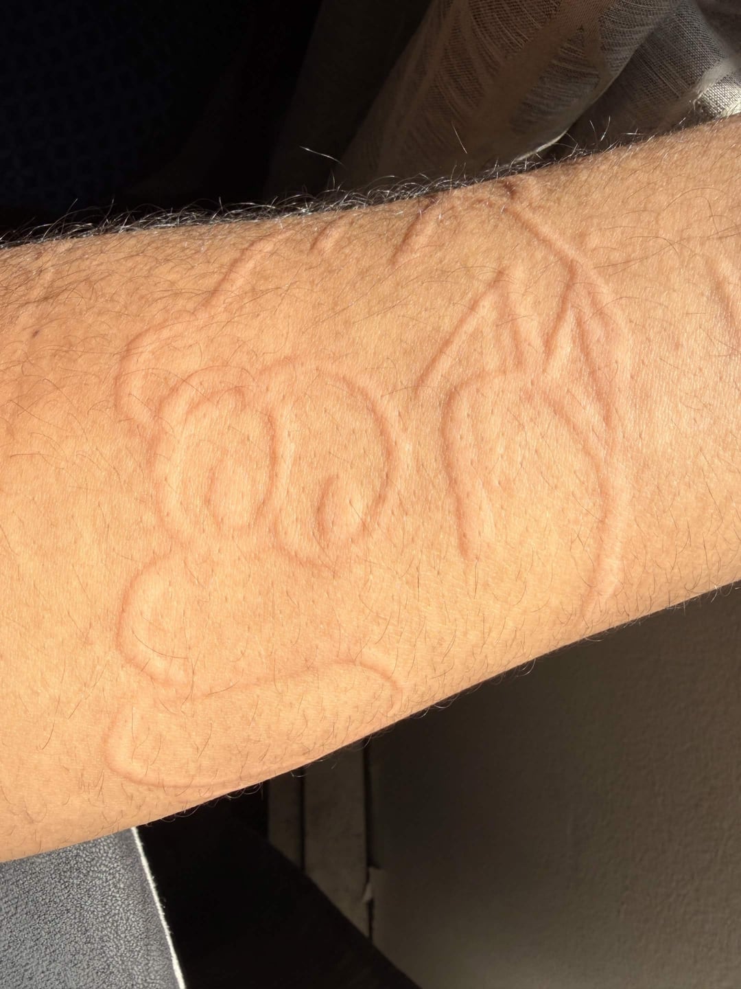 Imprint of a cartoon character on an arm, likely from resting on a surface
