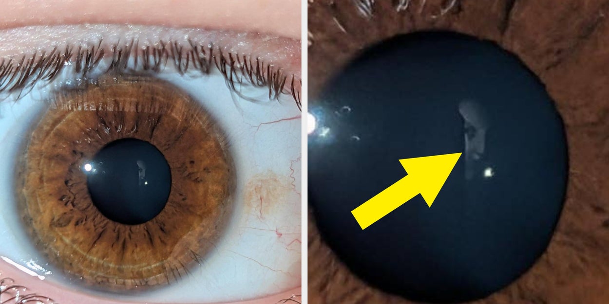 36 Weird And Interesting Reddit Photos