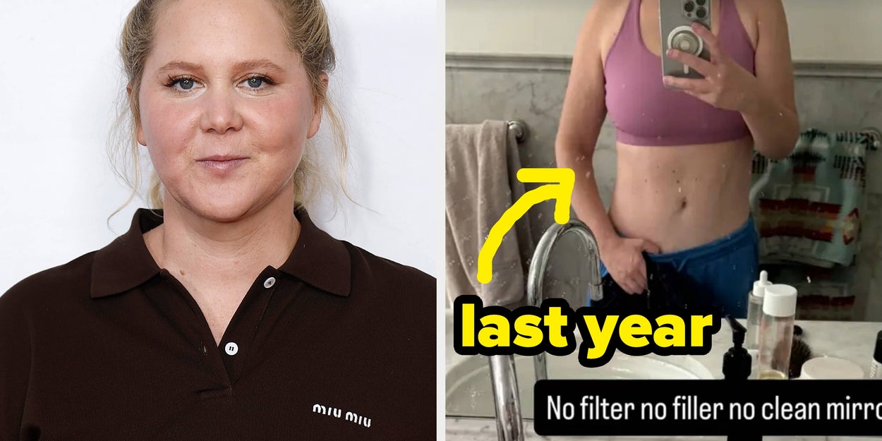 Amy Schumer Shares No-Filter Bikini Pics Post-Mounjaro