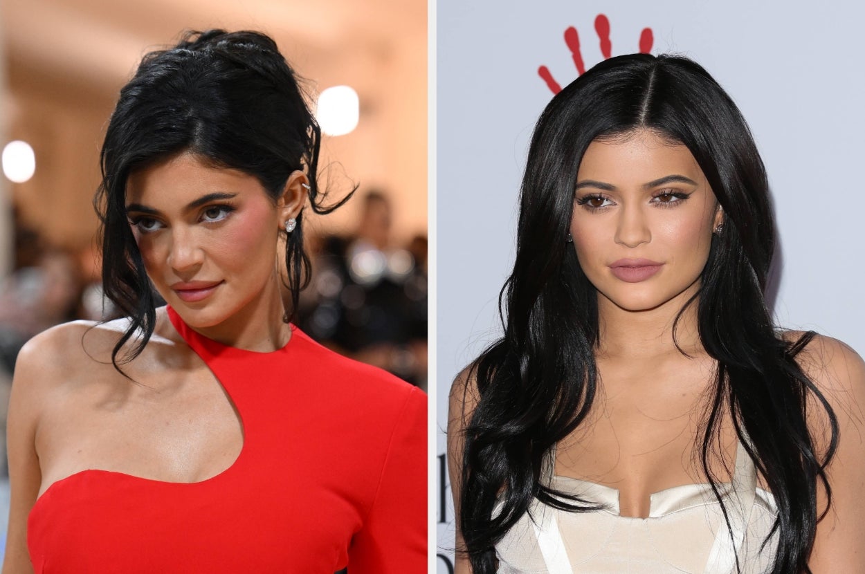 New Photos Of Kylie Jenner Are Going Viral Because People Think She’s Got Her “Old Face” Back