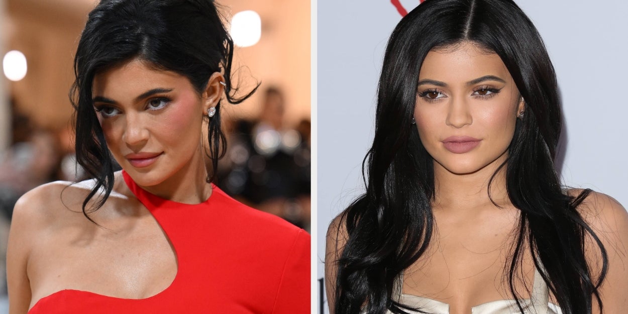 Fans Think Kylie Jenner Has 'Old Face' Back In New Pics