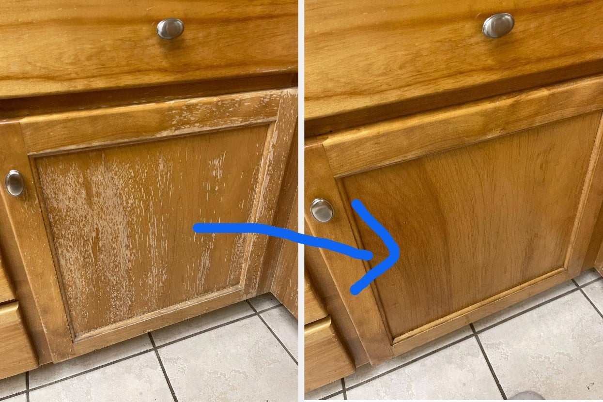 47 Things That’ll Help Deal With All Your “I Can’t Move Right Now” Frustrations