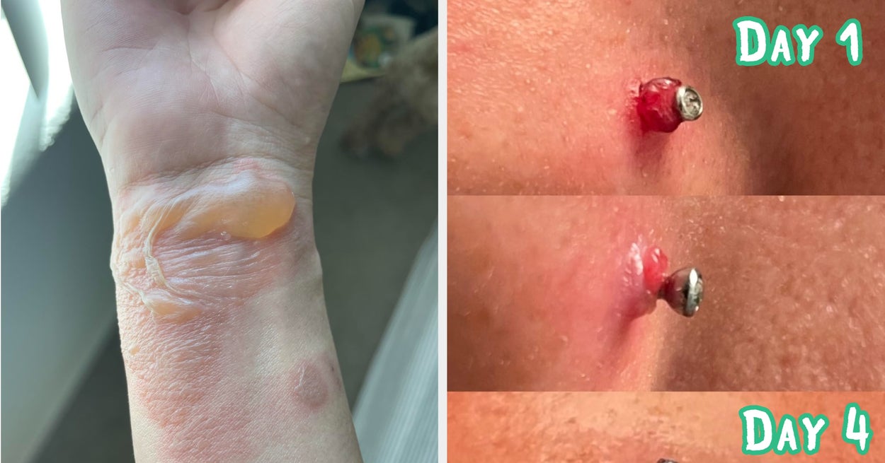 17 Personal Care Products With Goosebump-Inducing Before And After Photos
