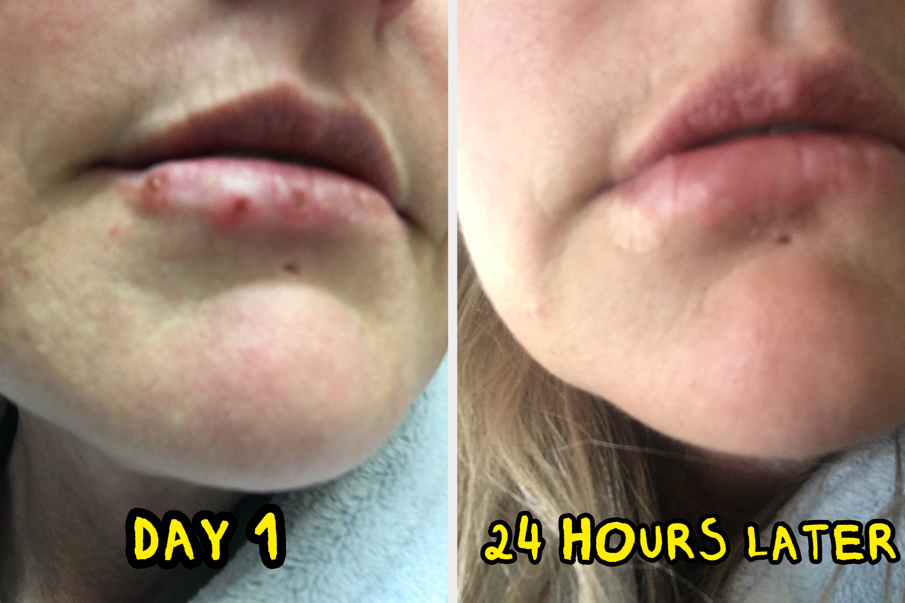 17 Personal Care Products With Goosebump-Inducing Before And After Photos