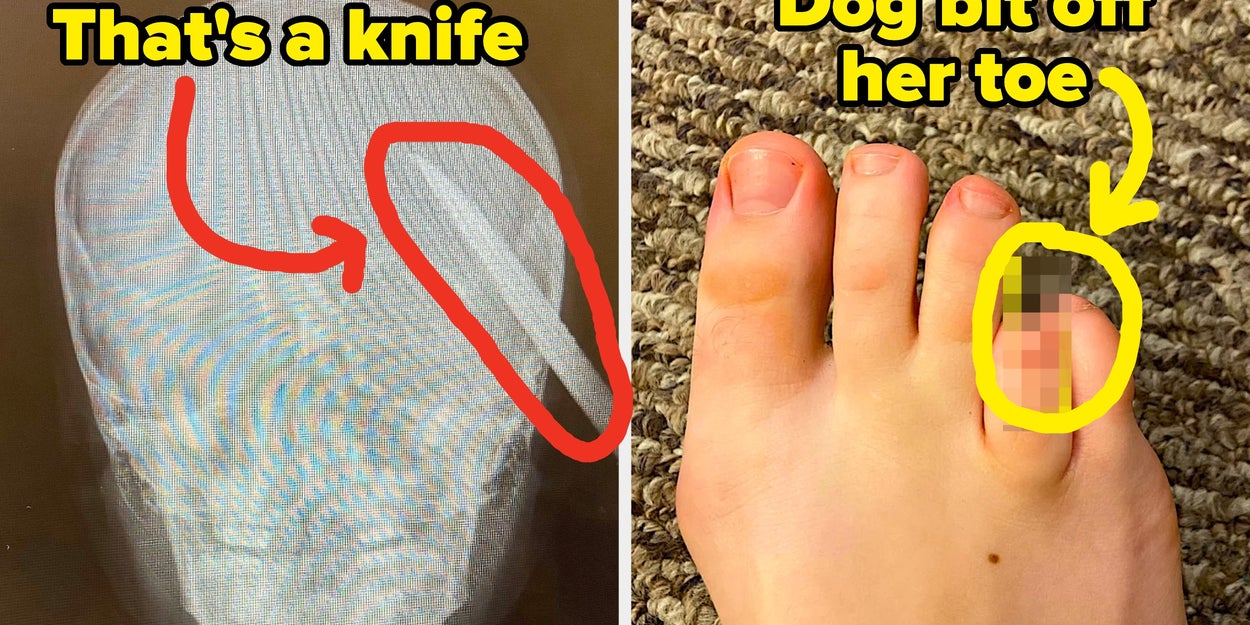23 Wildest Patient Stories From Healthcare Workers