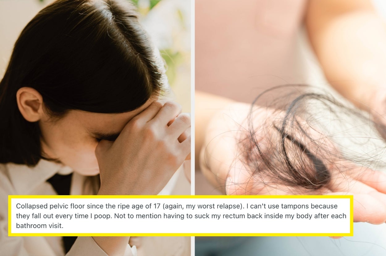 People In Recovery Are Sharing The Brutal Long-Term Consequences Of Their Eating Disorders, From Incontinence To Losing Their Eyesight