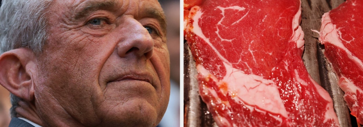Here's What Eating Like RFK Jr. Does To Your Colon, According To A Gastro Doctor
