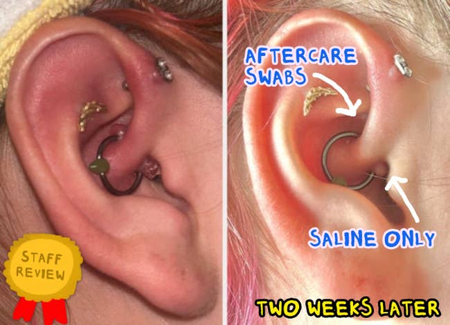 25 Products With Jaw-Dropping Before & After Pics