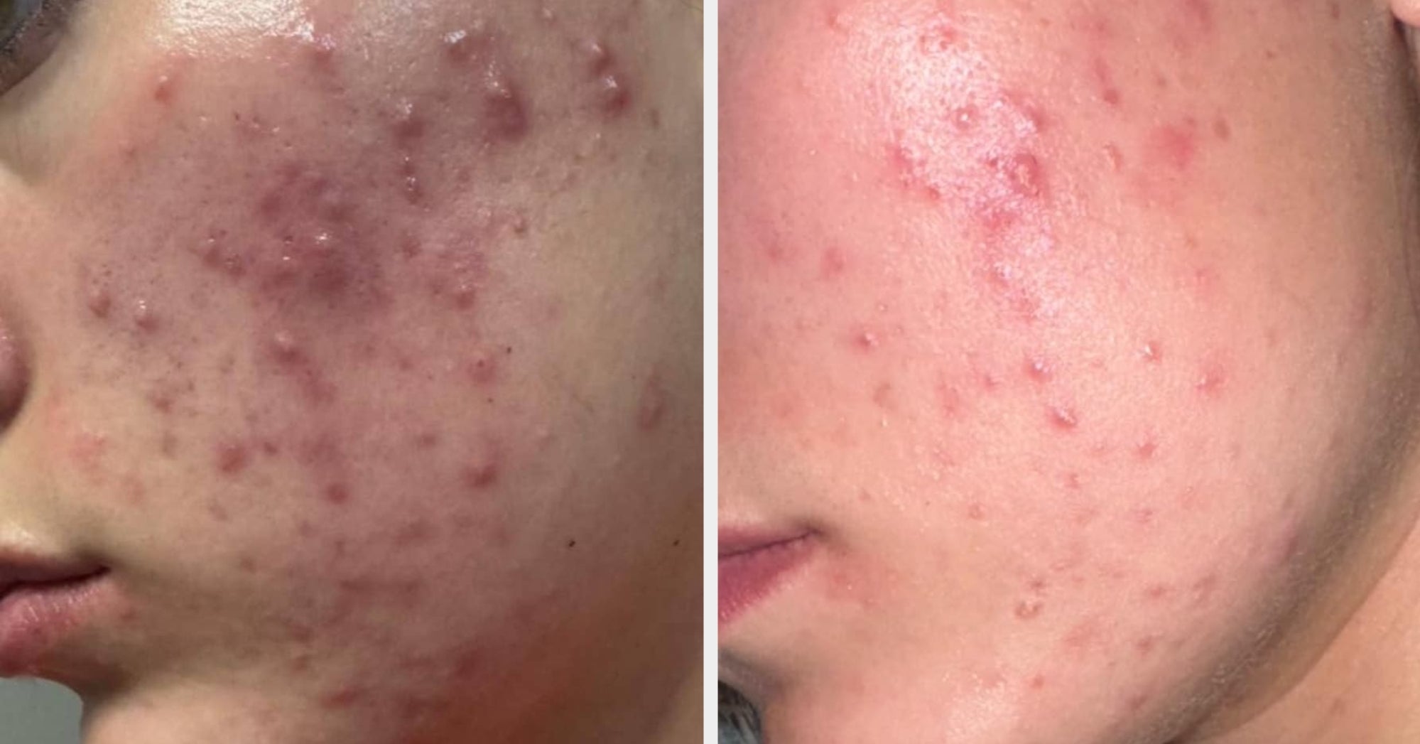 33 TikTok Beauty Products That Work So Exceedingly Well, You'll Wonder If Magic Is Involved