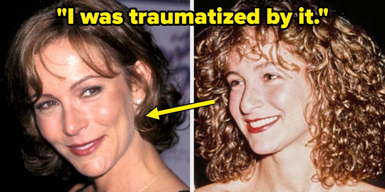11 Celebrities Reveal Their Plastic Surgery Histories