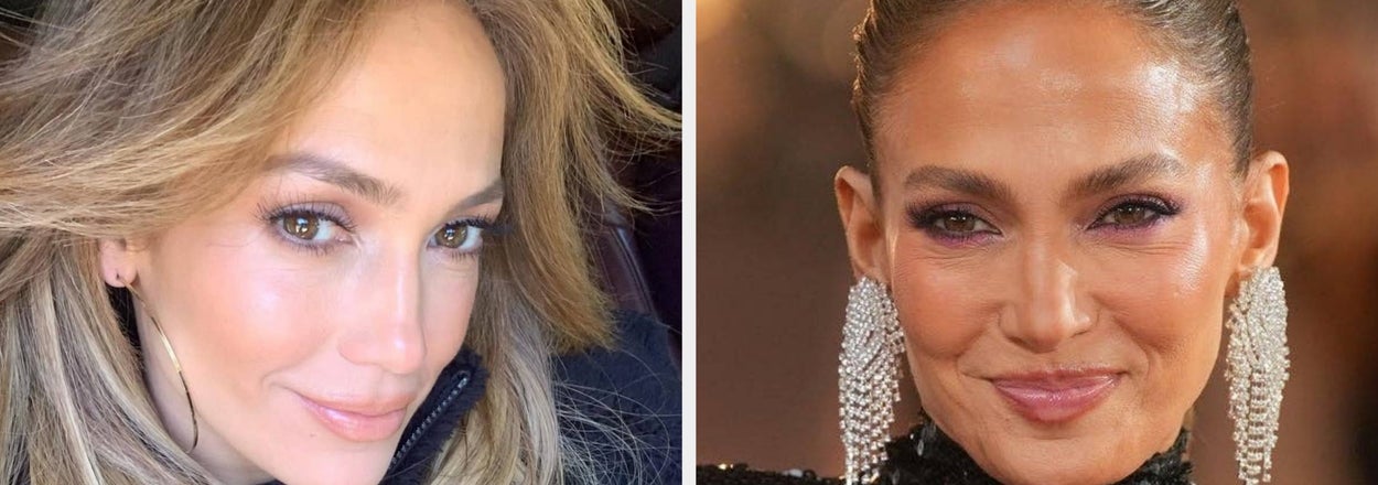 Jennifer Lopez Seemingly Avoided Erasing The Texture On Her Legs In New Skin-Baring Photos, And It’s Shockingly Refreshing
