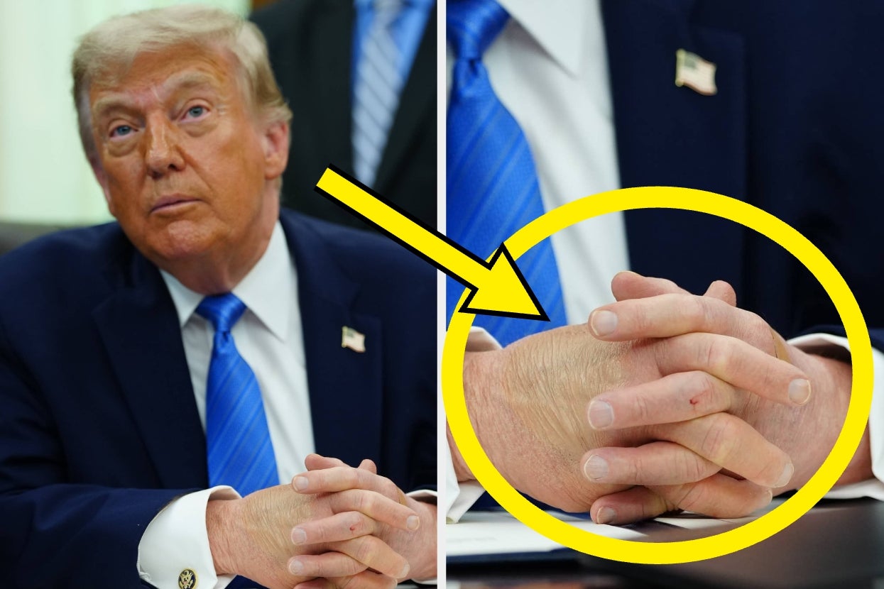A person sits at a desk in a suit, hands clasped. An arrow points to a close-up of their hands