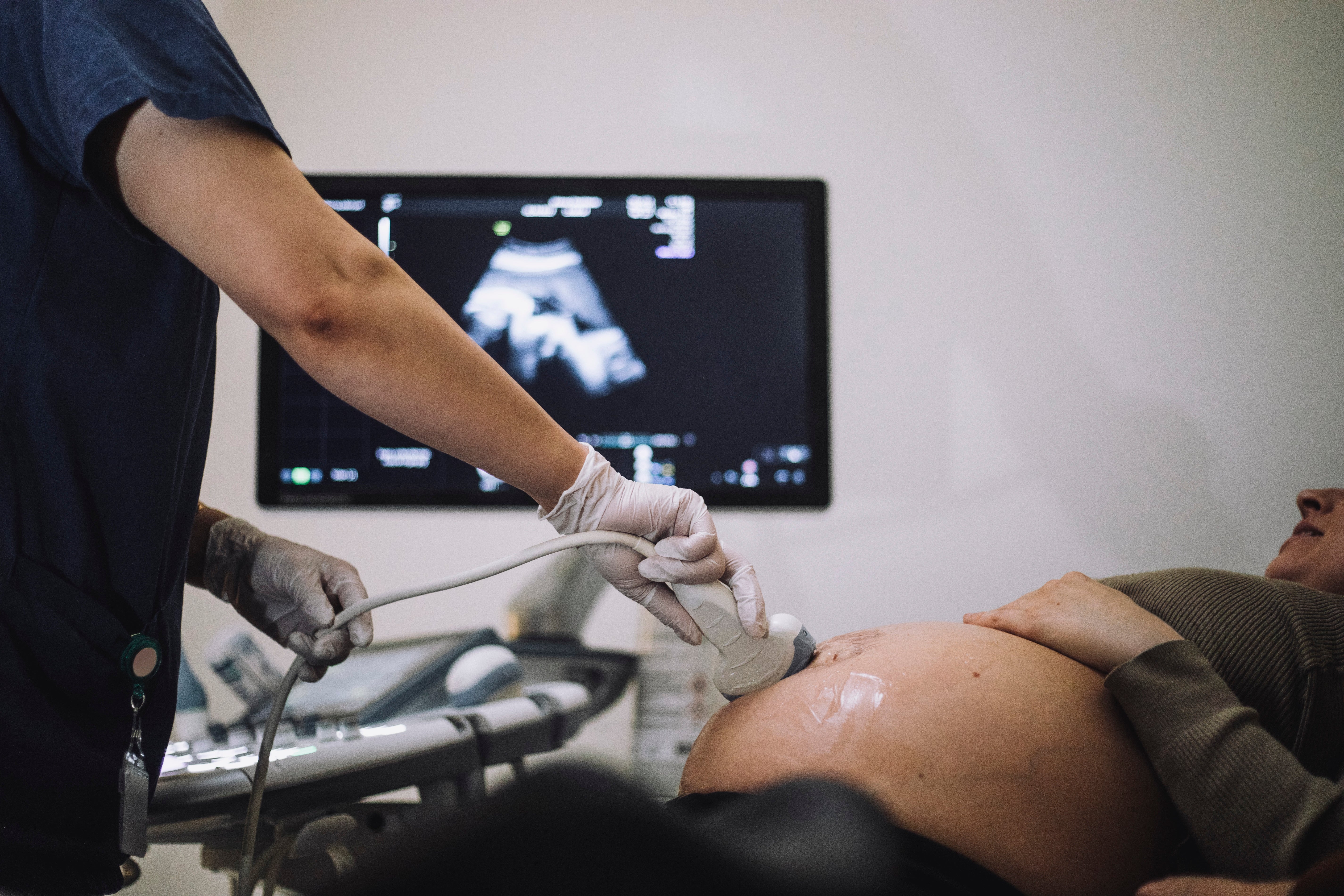En medisinsk fagperson utfører en ultralyd på en gravid pasient, med ultralydbildet synlig på en skjerm