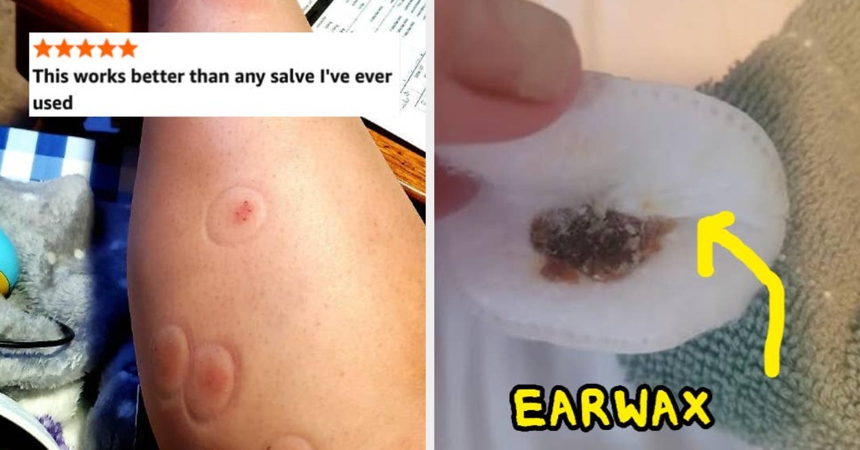 29 Products That Will Help With Uncomfy Issues That Fill You With Unmitigated Rage