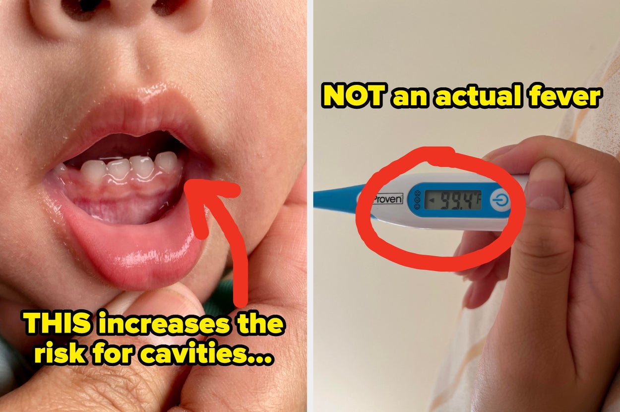 Close-up of child's teeth with arrow indicating cavities risk; digital thermometer reading 99.4°F with text suggesting it's not a fever