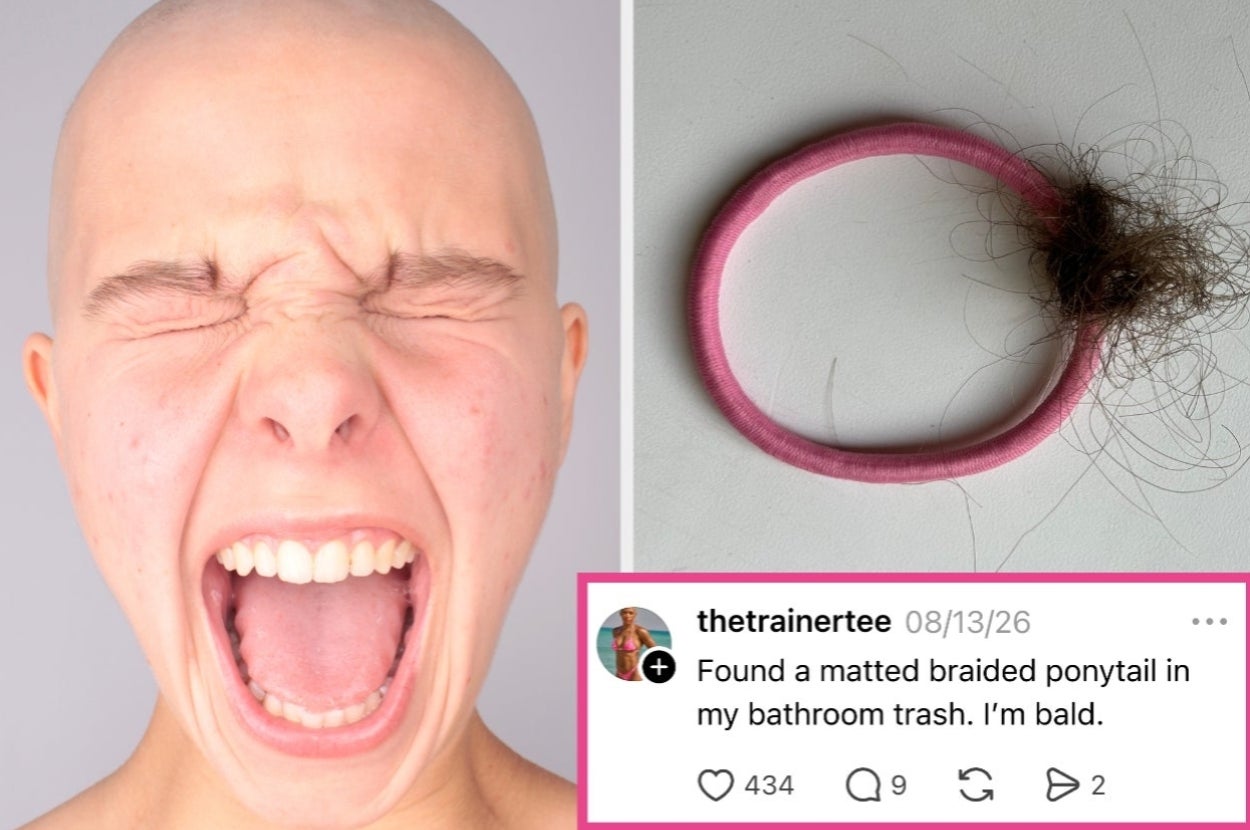 A person with a shaved head screams next to an image of a hair tie with hair. Caption: "Found a matted braided ponytail in my bathroom trash. I’m bald."