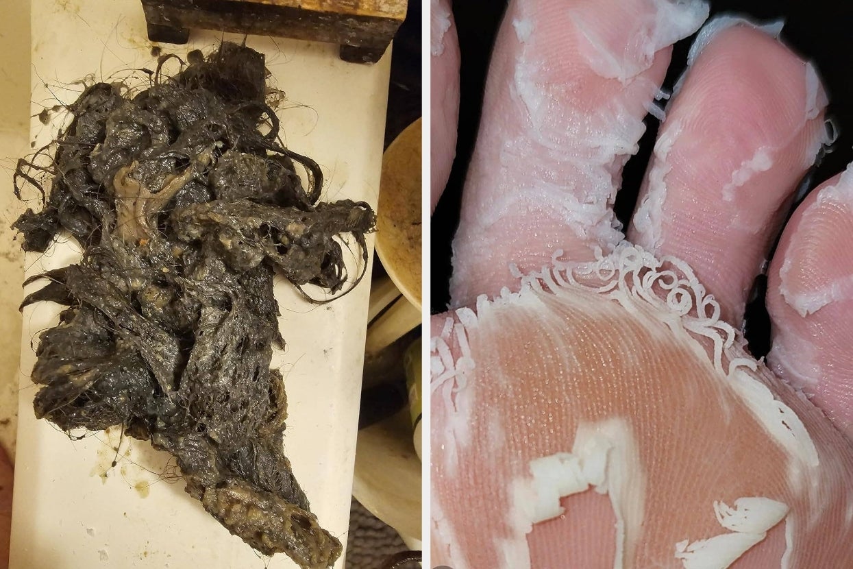 22 Products With Before And After Pics So Shocking, You Won’t Know Whether To Gag Or Gasp