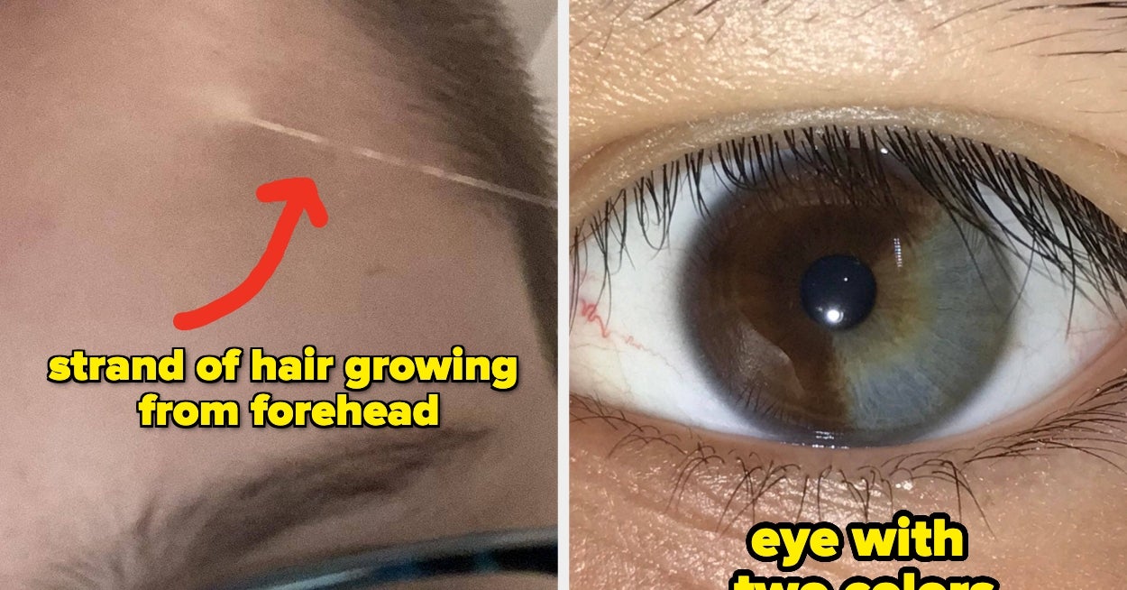 38 Jaw-Dropping Pictures Of The Human Body That Will Completely And Totally Change Your Perspective On Life - BuzzFeed image
