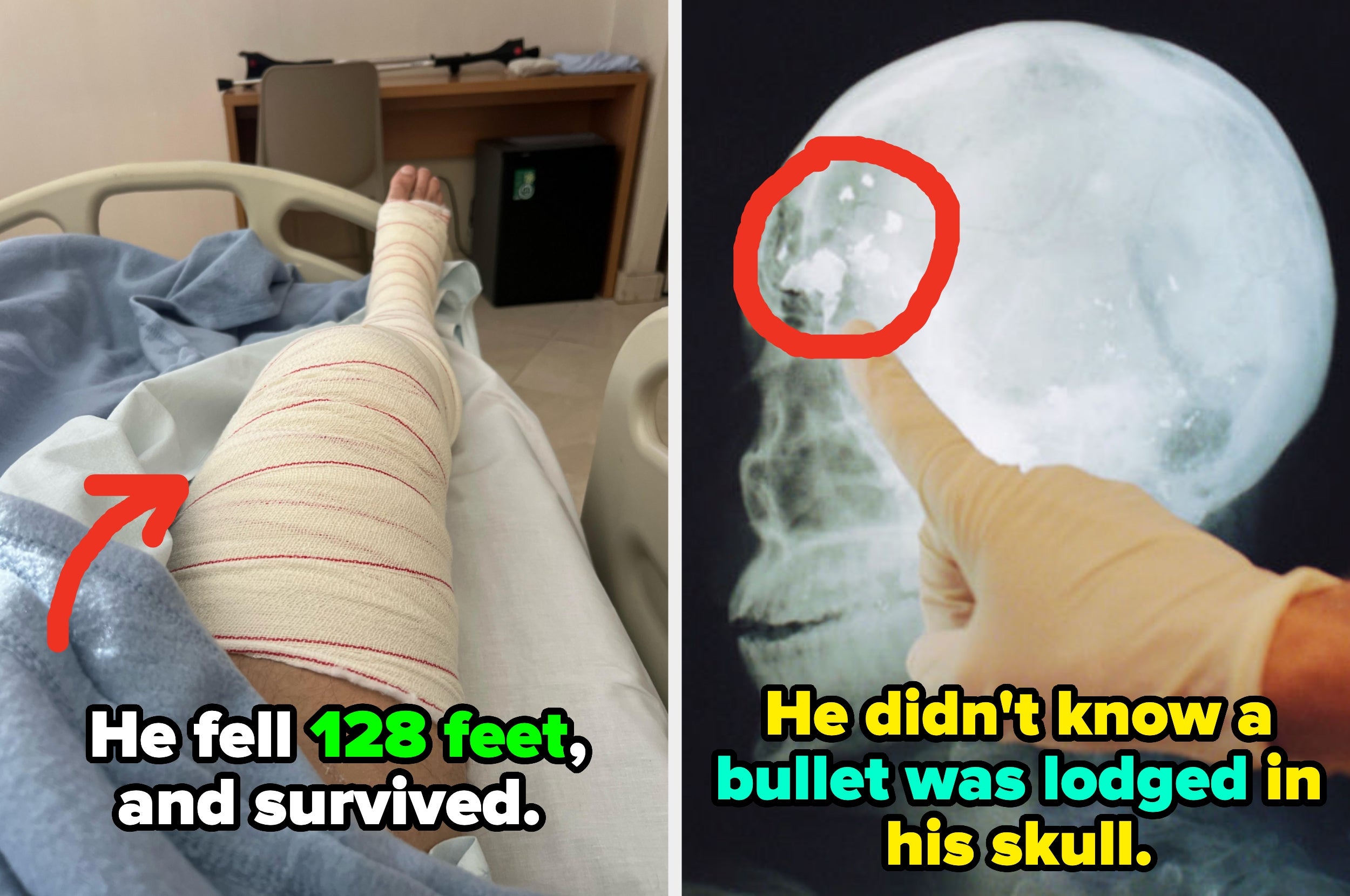 buzzfeed.com - Liz Richardson - 21 Absolutely Unbelievable 'How Did You Survive?!' Patient Stories, Straight From Medical Professionals
