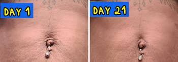 left: closeup of an ingrown toenail; middle: a long piece of earwax on a napkin; right: comparison of reviewer's undereyes, one darker and one lighter