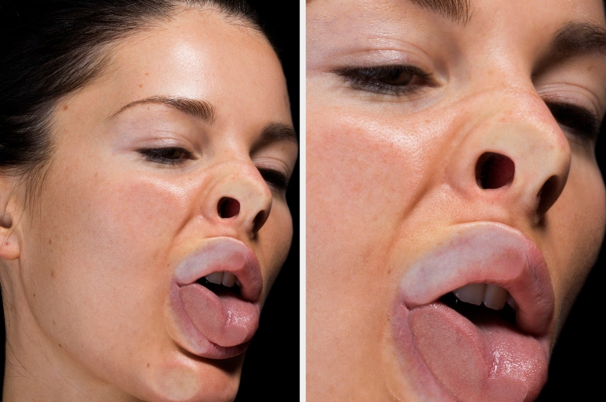 People Are Dropping Like Flies After Seeing This Viral Post About A "Meat Tooth," And I'm Sorry For What You're About To Read