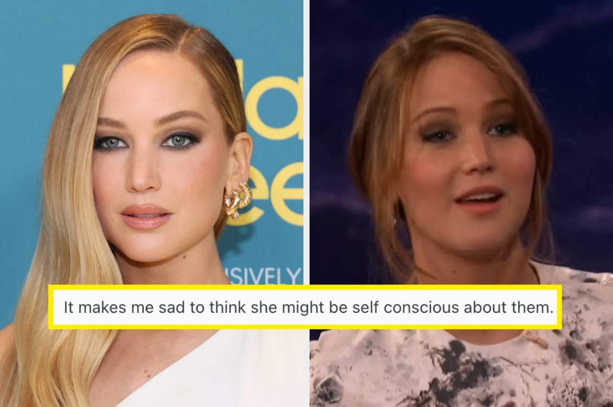 Two side-by-side images of a woman: left in glamorous attire, right speaking on a talk show. Caption: "It makes me sad to think she might be self-conscious about them."