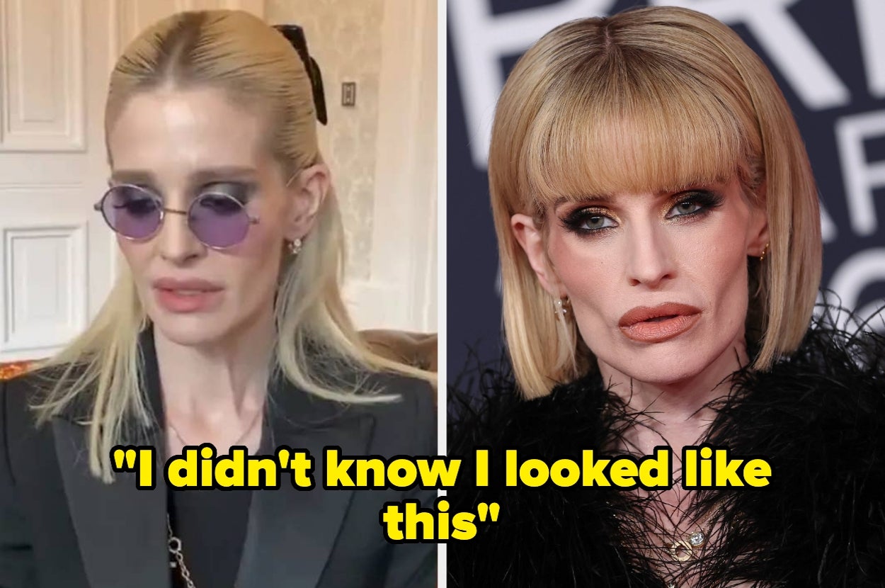 “I Didn’t Know I Looked Like This”: Kelly Osbourne Has Recalled The Moment She Realized How Unwell She Was After Hitting Back At Concerns Over Her Extreme Weight Loss