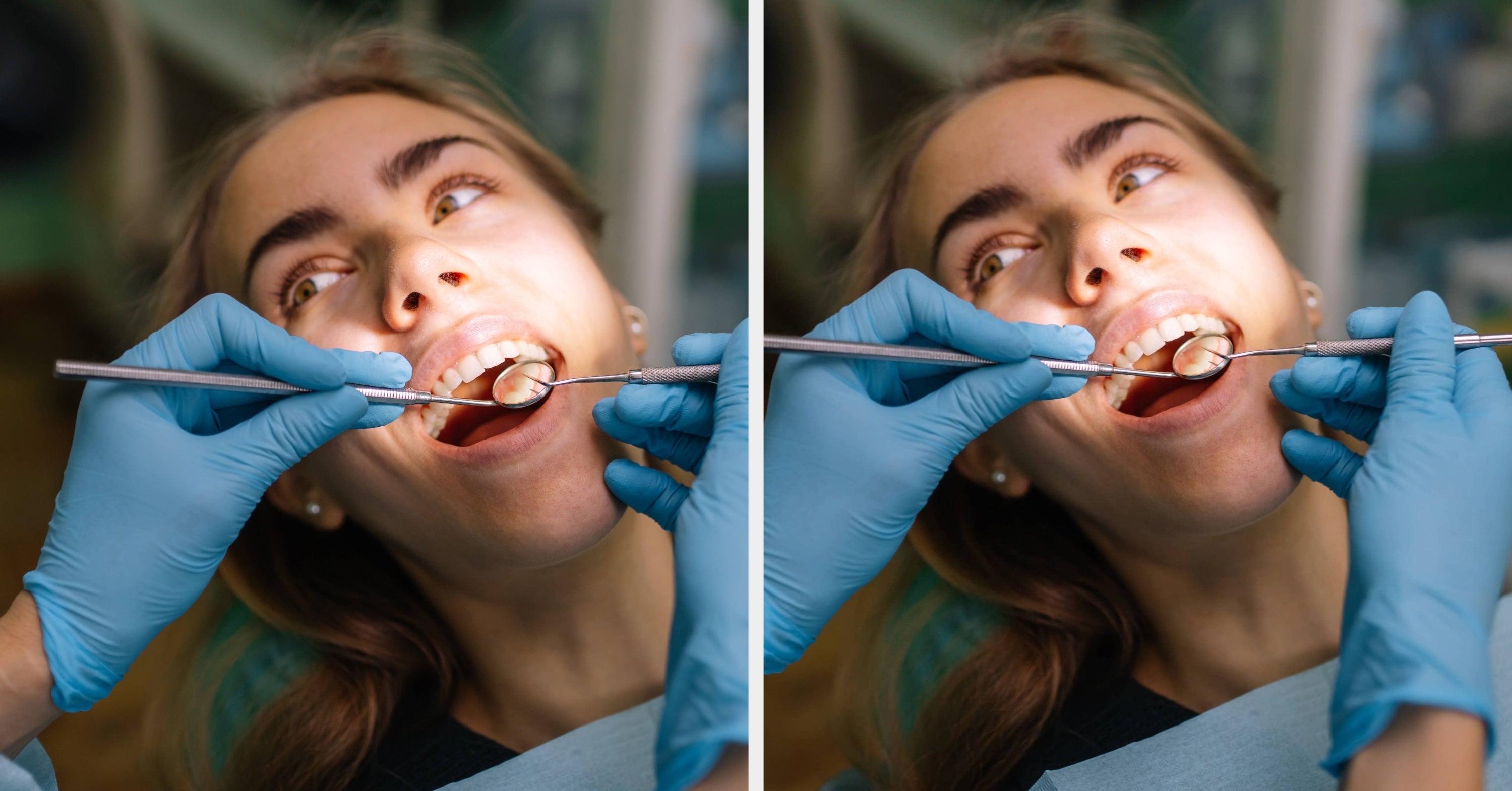 “I Know It Seems Counterintuitive, But...”: Dentists Are Sharing The Most Common Mistakes They See Patients Make
