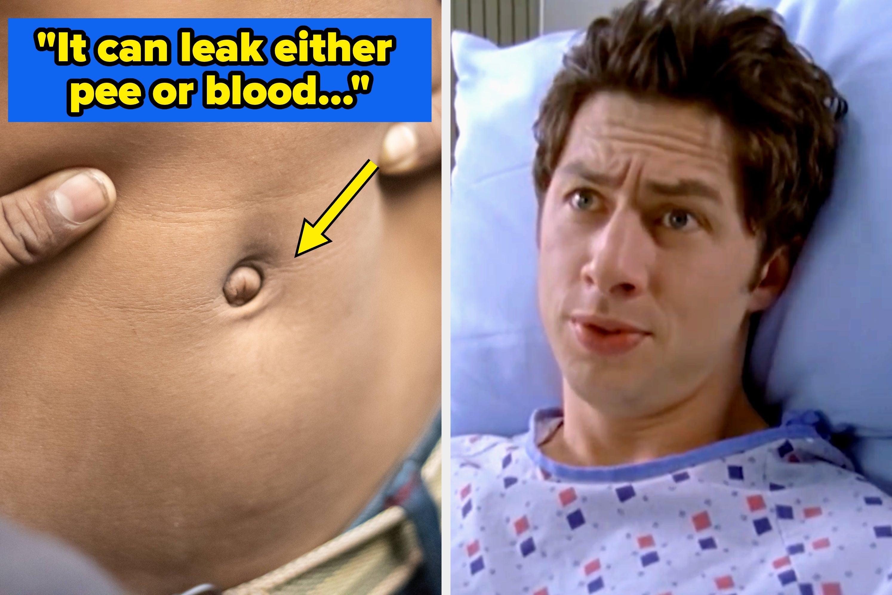 A healthcare professional with a stethoscope looks thoughtful. Next to her, there's a close-up of an adult's belly button with a medical concern caption