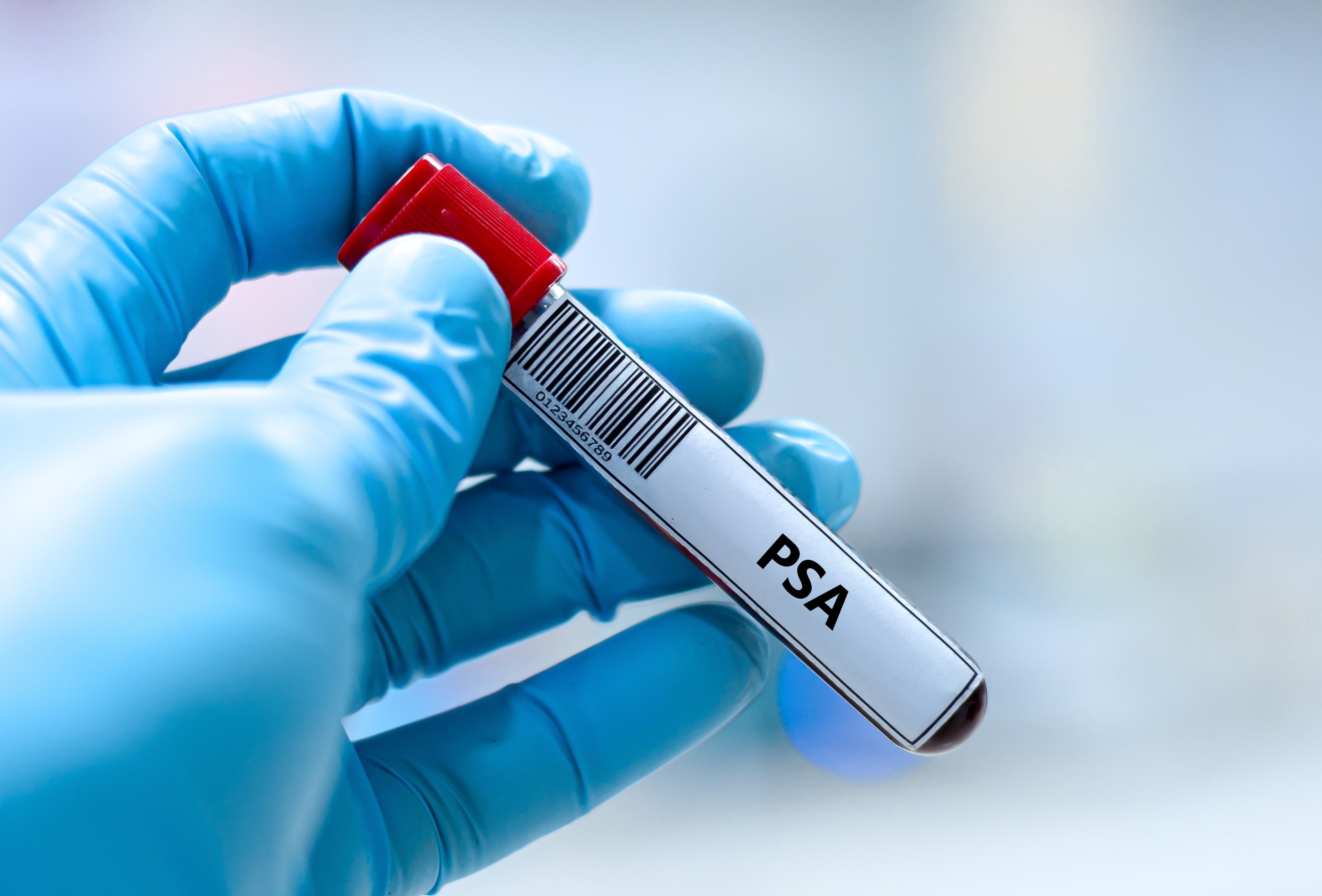 A gloved hand holds a test tube labeled "PSA," indicating a prostate-specific antigen test, relevant to health screening