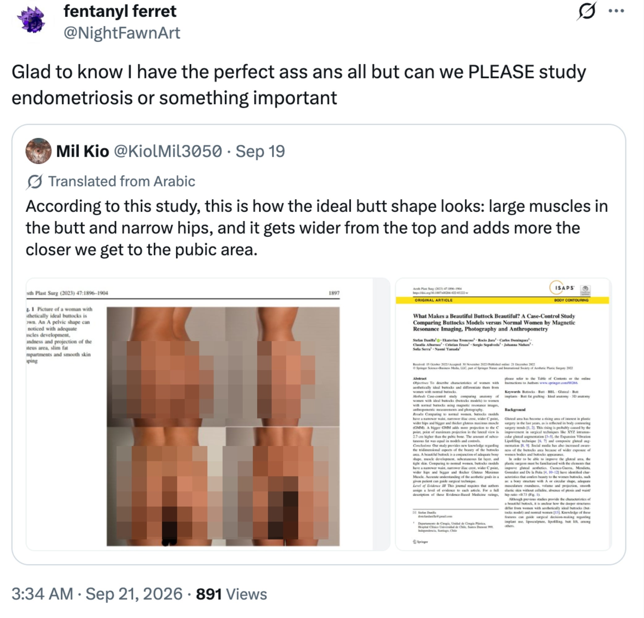 Tweet om en studie om ideell rumpeform med humoristiske kommentarer om å studere viktige emner som endometriose