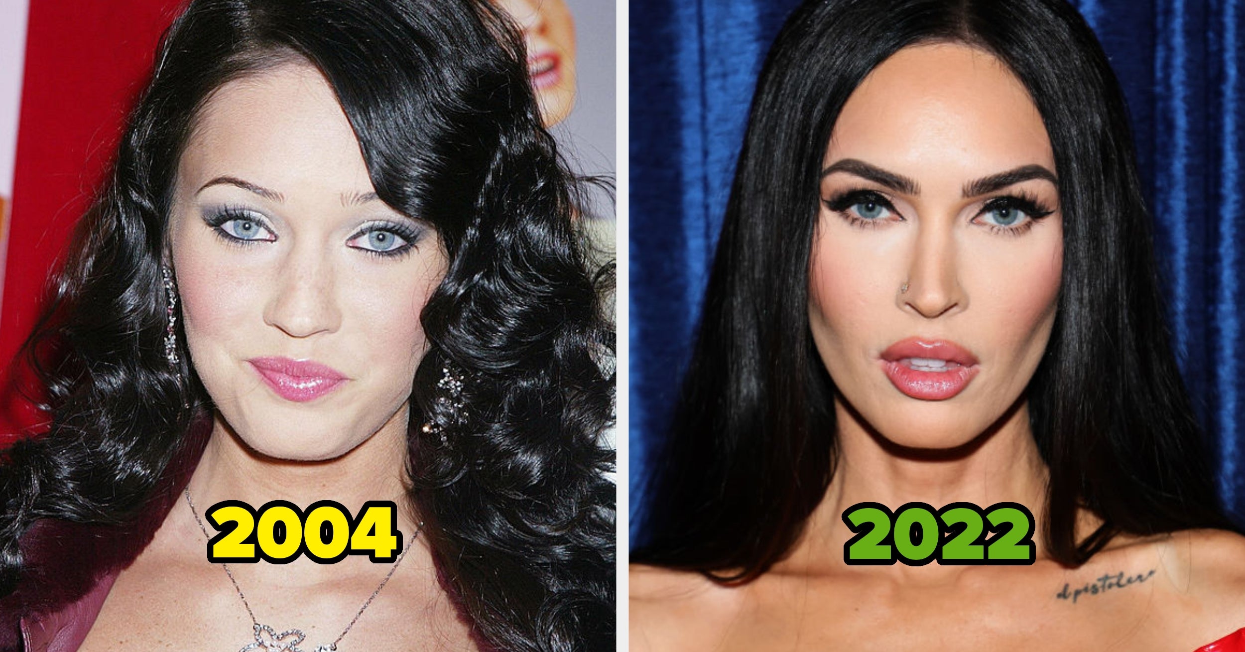 20 Famous People Who Got Unapologetically Candid About Their Plastic Surgery