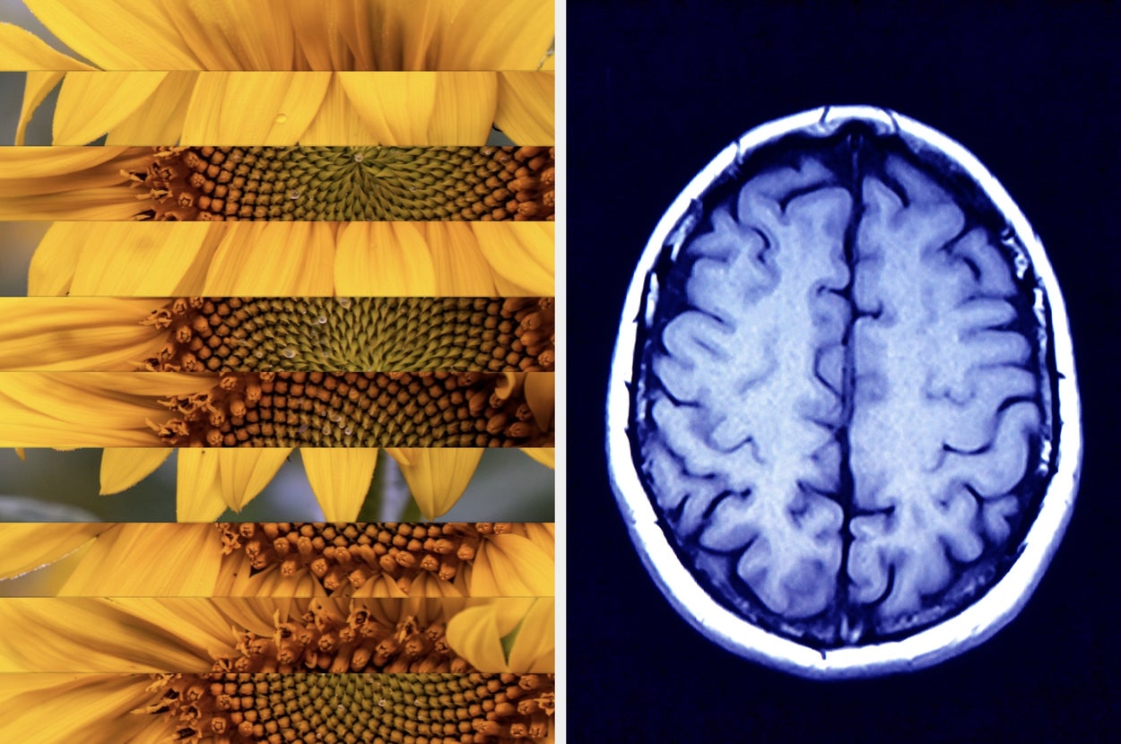 This Picture Puzzle Test Will Stimulate Your Left And Right Brain Simultaneously