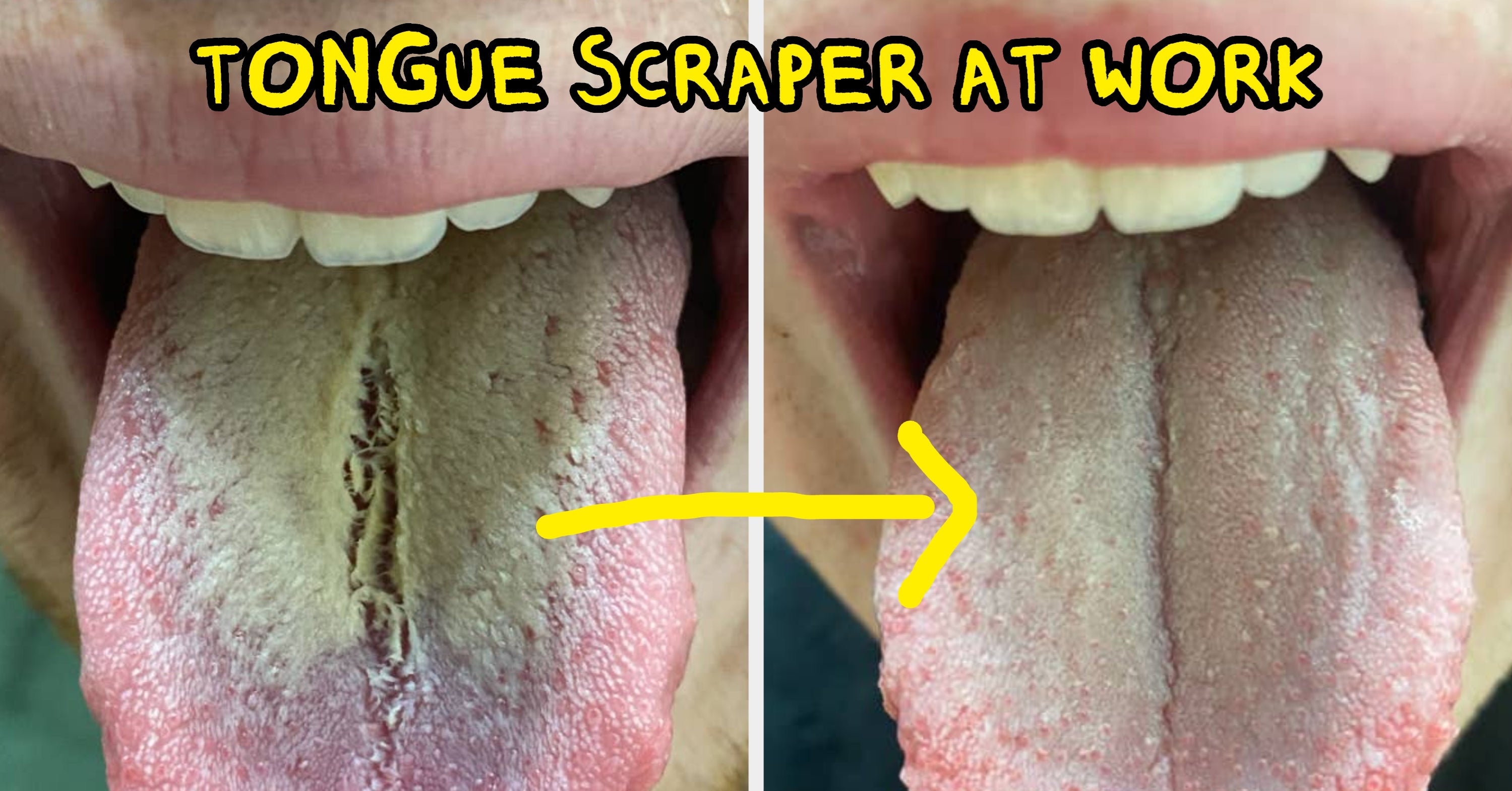 A Tongue Scraper, $5 Foot Peeling Spray, And 33 Other Things That’ll Transform Your Personal Care Routine