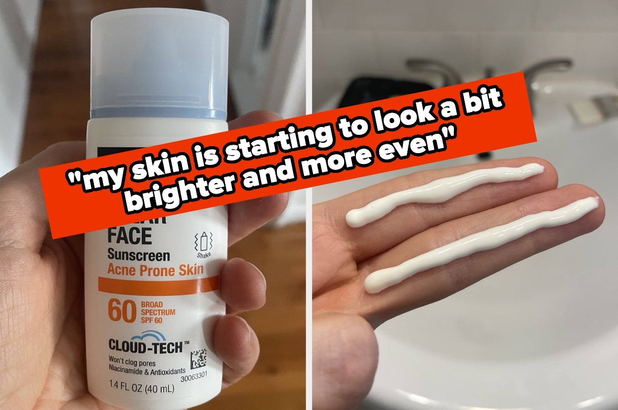 Sunscreen bottle for acne-prone skin and sunscreen swatches on hand, with text noting skin looking brighter and more even