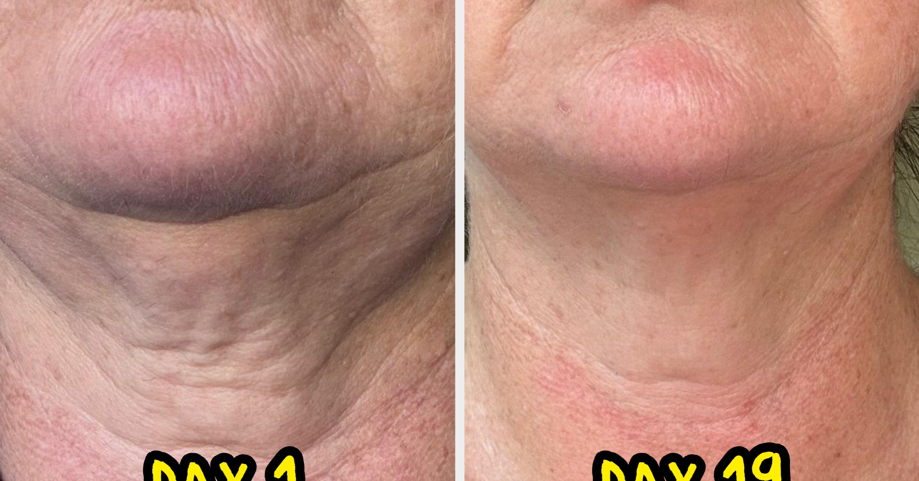 33 Before And Afters That Prove These 33 Body Care Products *Actually* Work